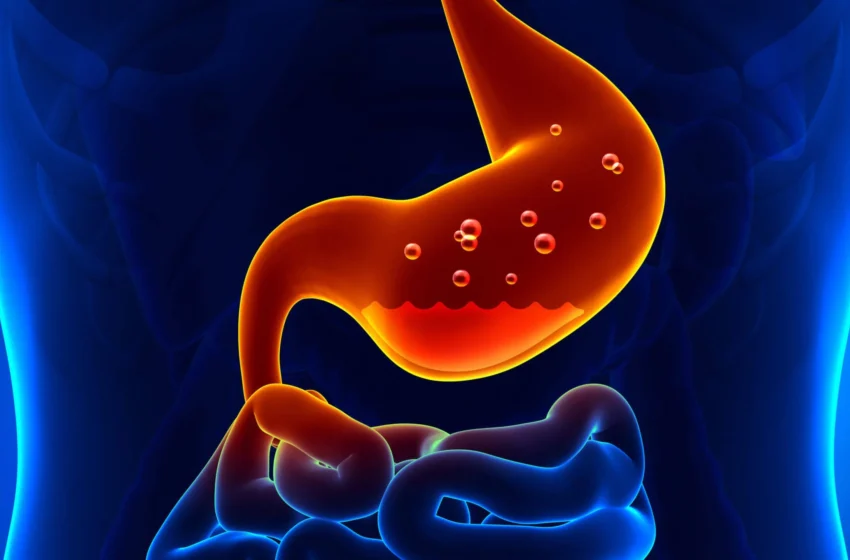 Understanding Heartburn: Causes, Symptoms, and Relief