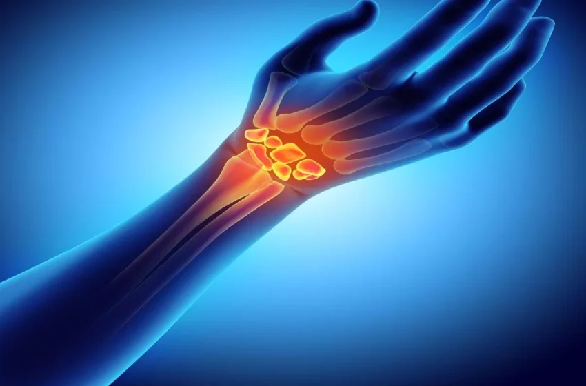 Understanding Rheumatoid Arthritis: Symptoms, Stages, and Treatment